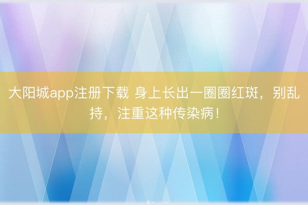 大阳城app注册下载 身上长出一圈圈红斑，别乱持，注重这种传染病！